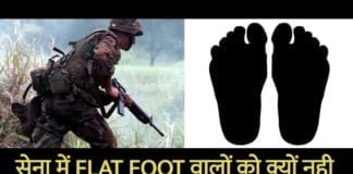 फ्लैट फुट (समतल पैर) वालो को सेना में क्यों नहीं लिया जाता?