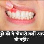 मसूड़ों की ये बीमारी कहीं आपको तो नहीं?