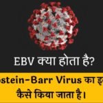 EBV क्या होता है? (Epstein-Barr Virus का इलाज कैसे किया जाता है)