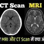 MRI और CT Scan में क्या अंतर होता है आसान भाषा मे।